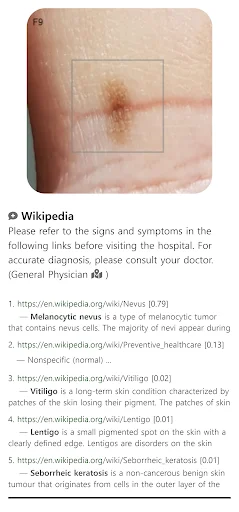 Baixar Model Dermatol – Atlas de Doenças de Pele Grátis - Screenshot 4
